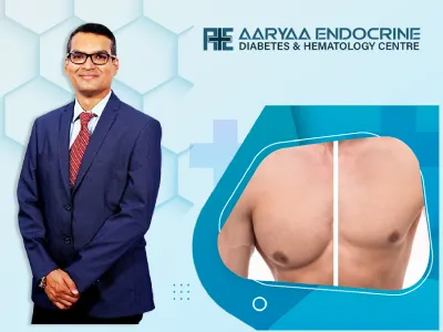Gynecomastia in Men Causes Health Risks