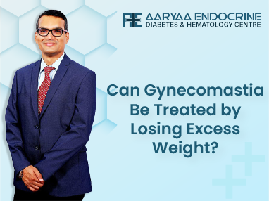 Can Gynecomastia Be Treated by Losing Excess Weight?