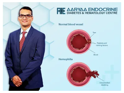 What Is Hemophilia and What Causes It
